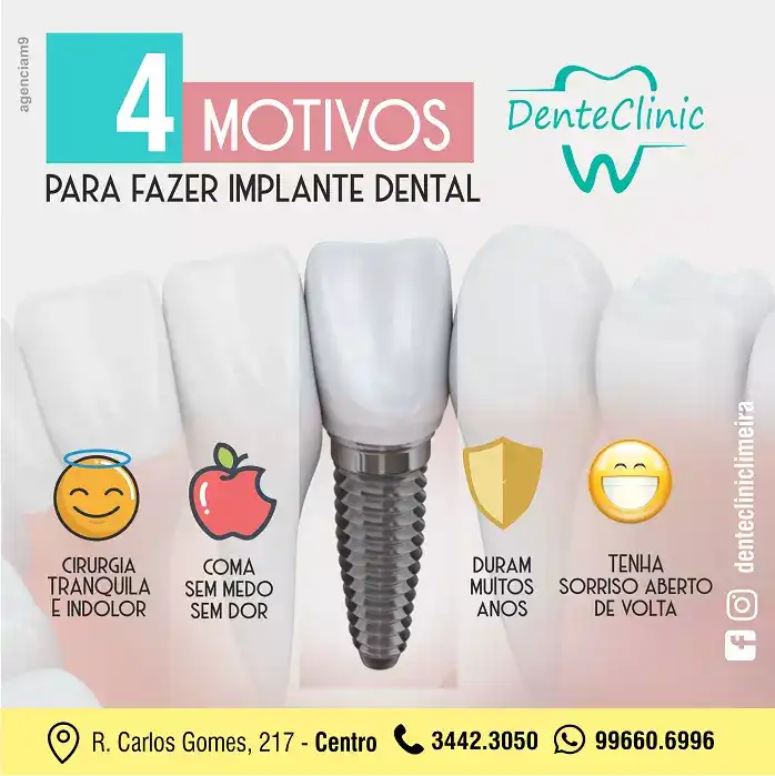Arte criada com o tema 4 motivos para fazer implante dental para clínica odontológica
