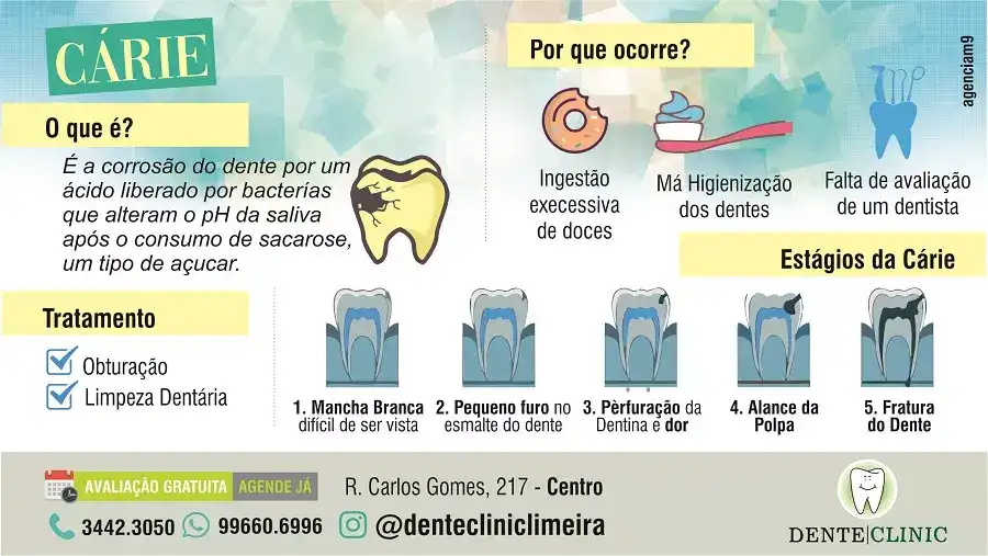Arte sobre Cárie criada para Centro Odontológico e Dentista
