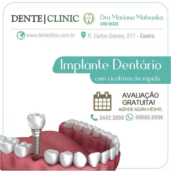 Arte sobre Implante Dentário criado para Clínica Odontológica Dentista-1

