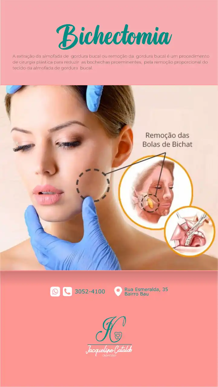 
Cartaz Interno Clínica Odontológica e Estétoica Facial sobre Bichectomia



