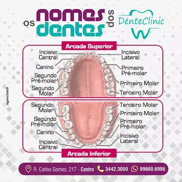 Infográfico sobre os nomes dos Dentes criado para Clínica Odontológica
