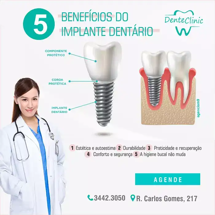 
Propaganda Benefícios do Implante Dentário



