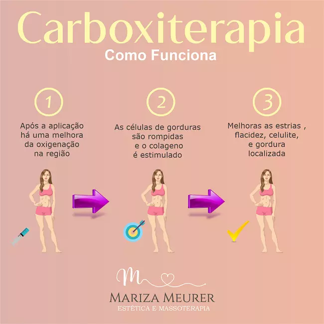 
Propaganda Carboxiterapia como Funciona Estética Corporal



