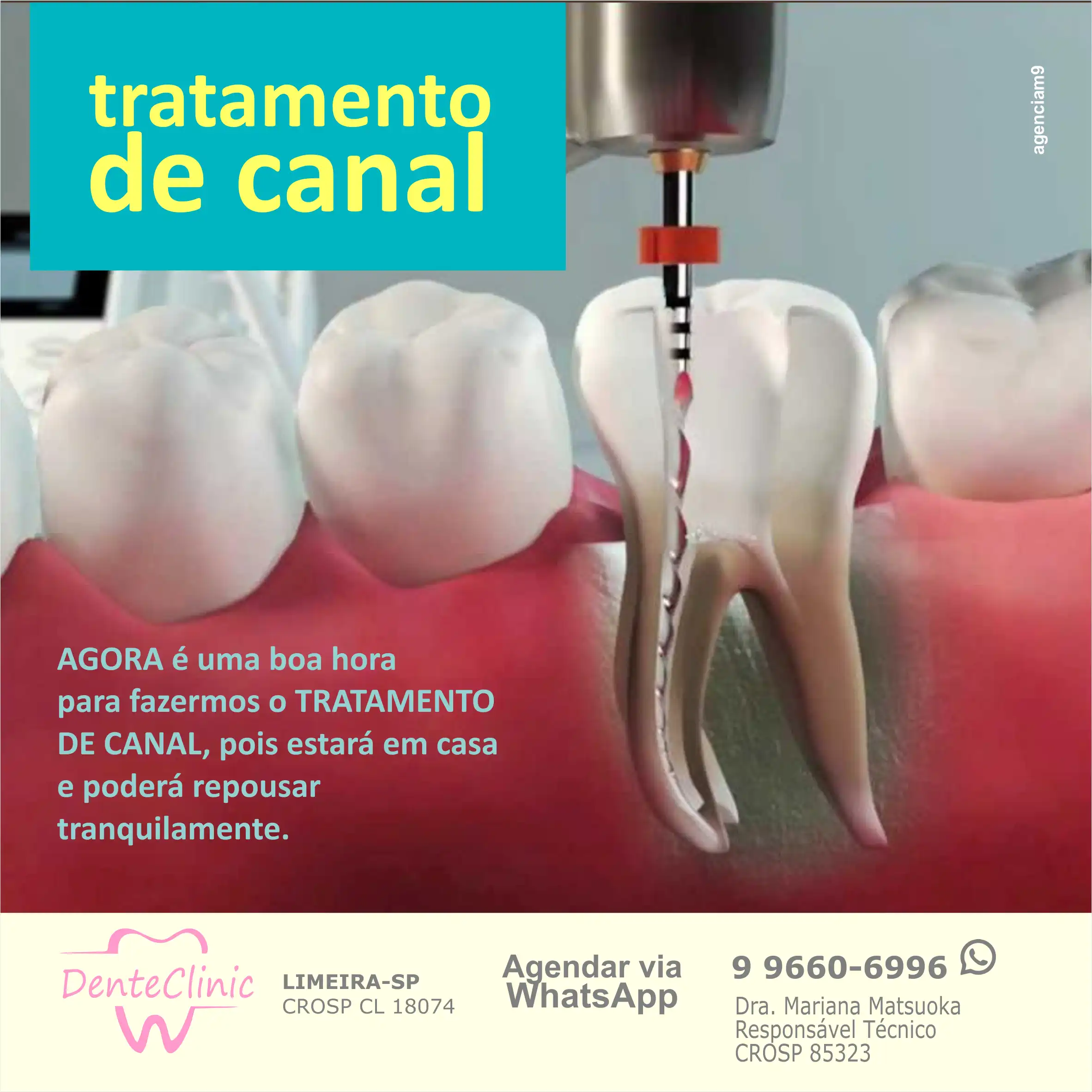 
Propaganda Dentista Tratamento de Canal



