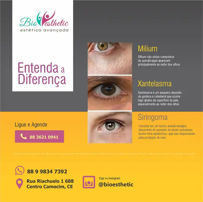 Propaganda Estética Facial sobre Milium Xantelasma e Siringoma
