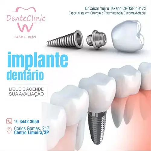
Propaganda Implante Dental




