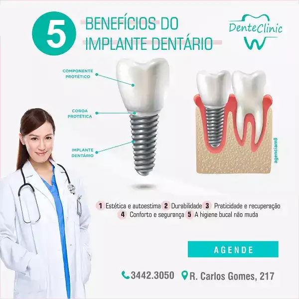 
Propaganda Implante Dentário



