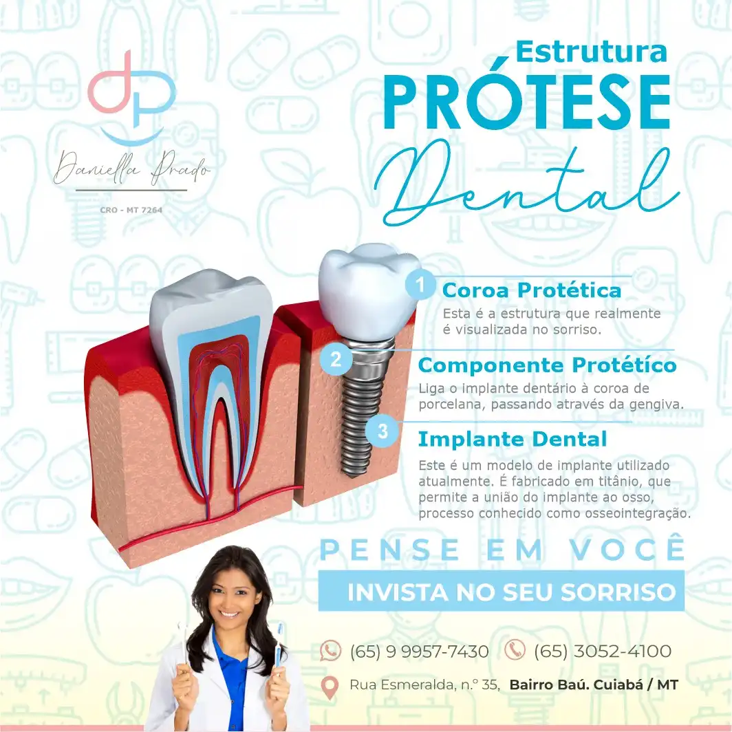 
Propaganda Post Estrutura da Prótese Dental



