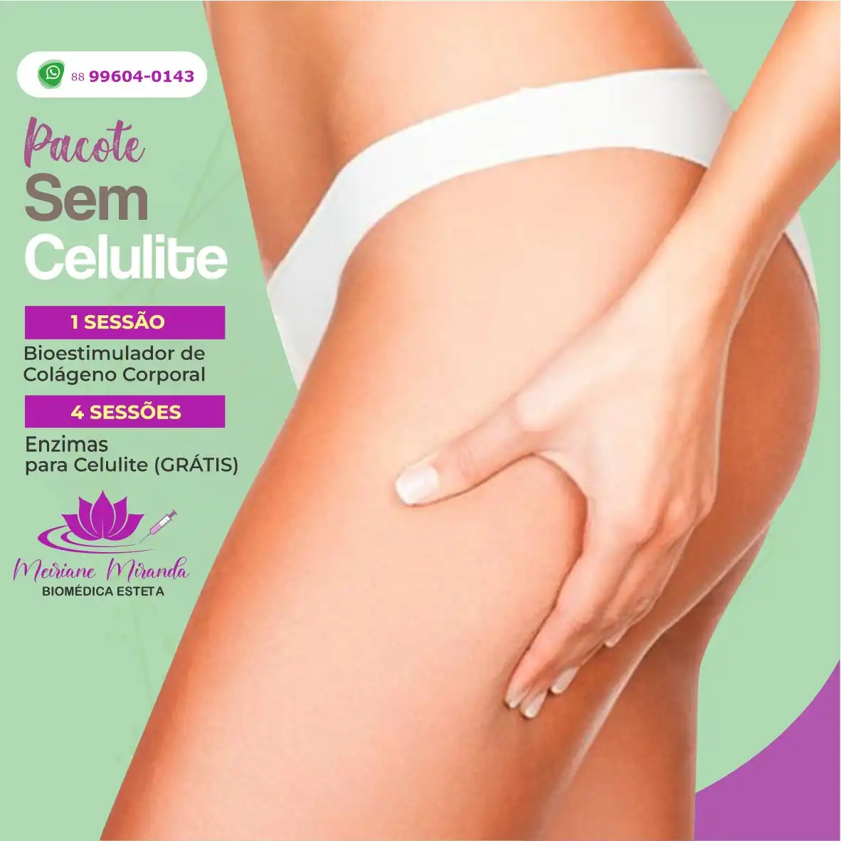 
Propaganda Post Redução Celulite Corporal



