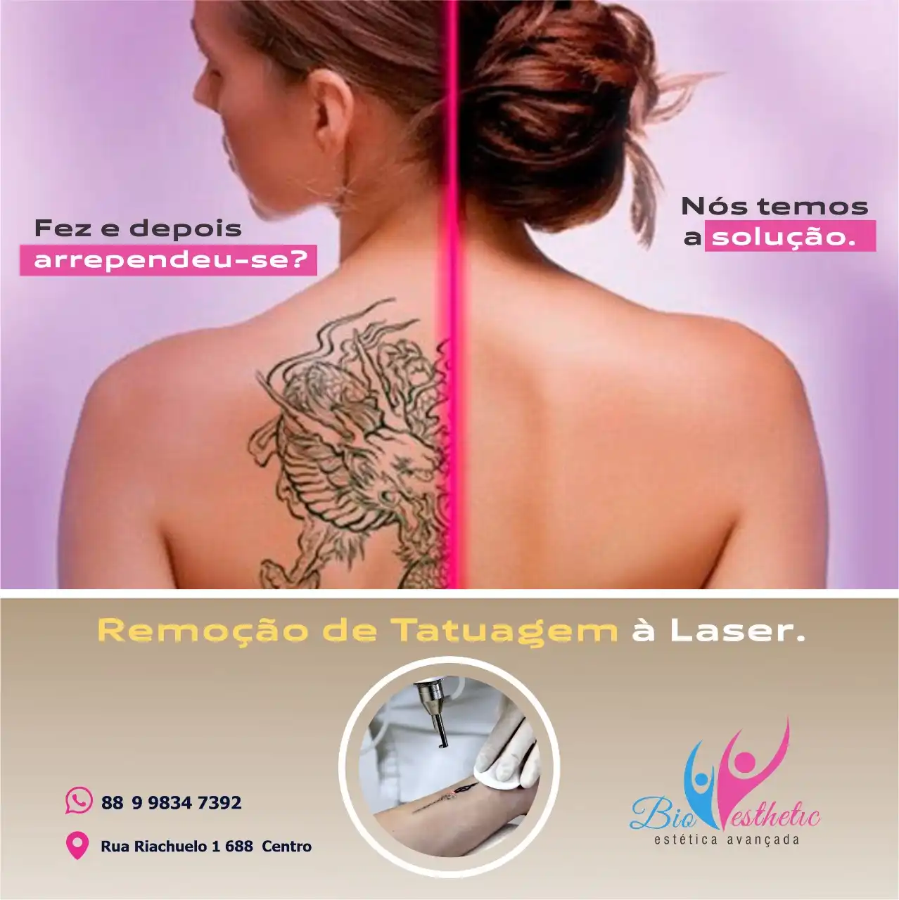 
Propaganda Post Remoção de Tatuagem à Lase Estética



