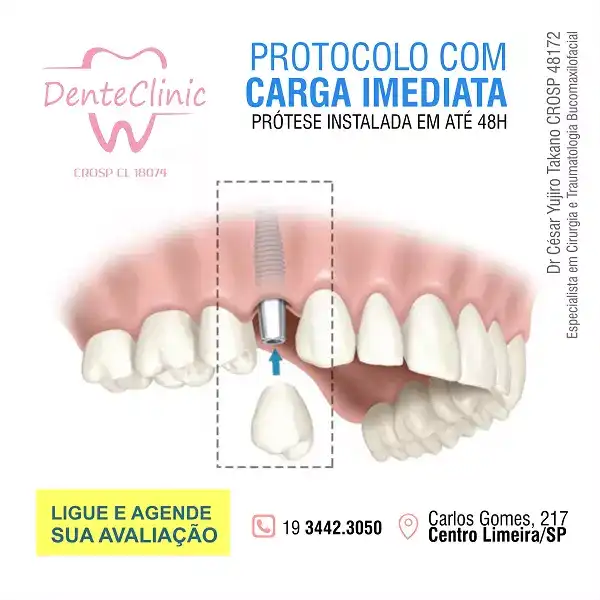 
Propaganda Protocolo Carga Imediata



