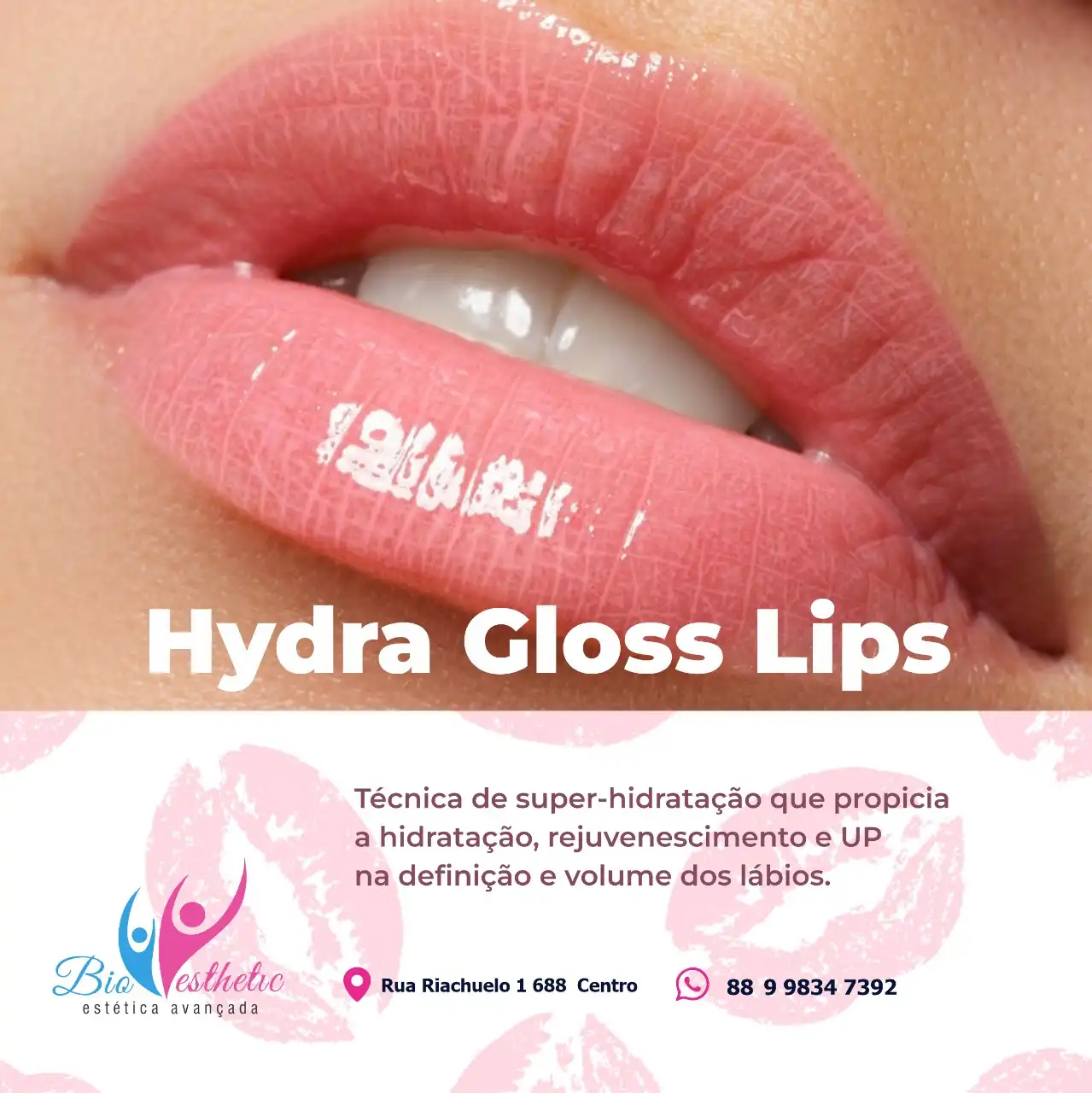 
Propaganda de Post  sobre Hydra Gloss Lips Estética Facial



