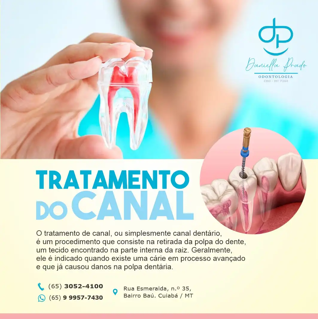 
Propaganda de Post Tratamento de Canal Dentista



