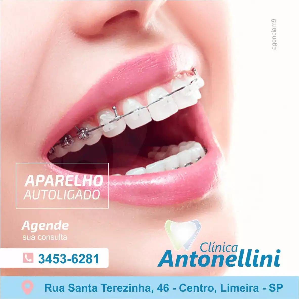 
Propaganda sobre Aparelho Autoligado para Dentista




