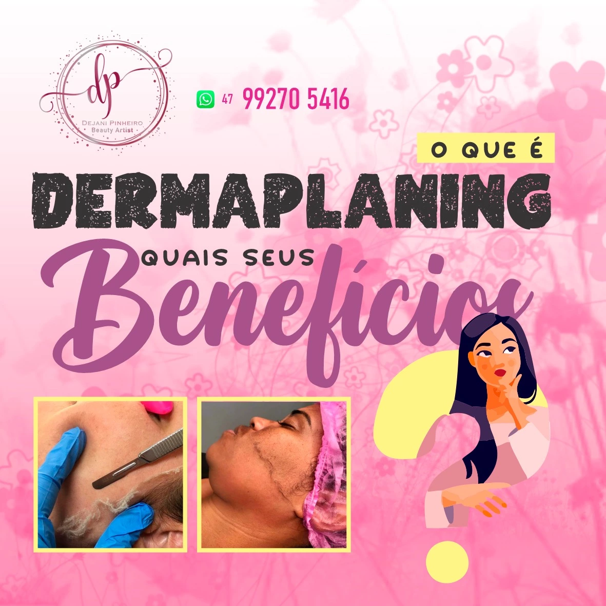 
Propaganda sobre Dermaplaning procedimento estético facial



