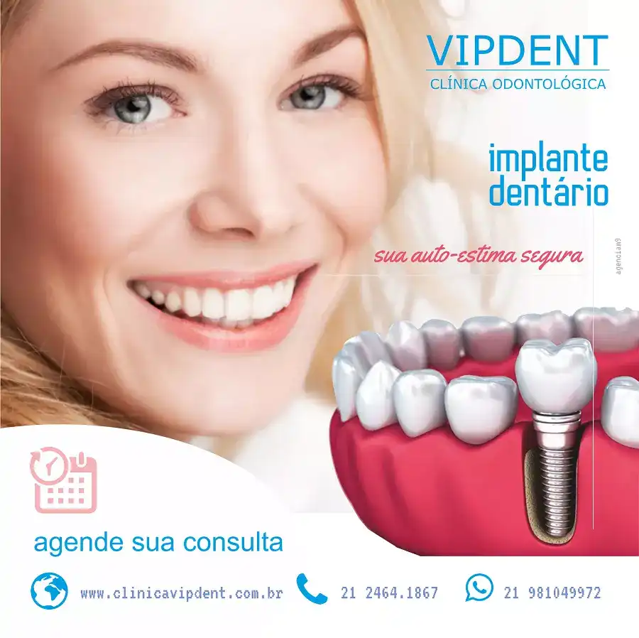 Propaganda sobre Implante Dentário criada para Clínica Odontológica do Rio de Janeiro
