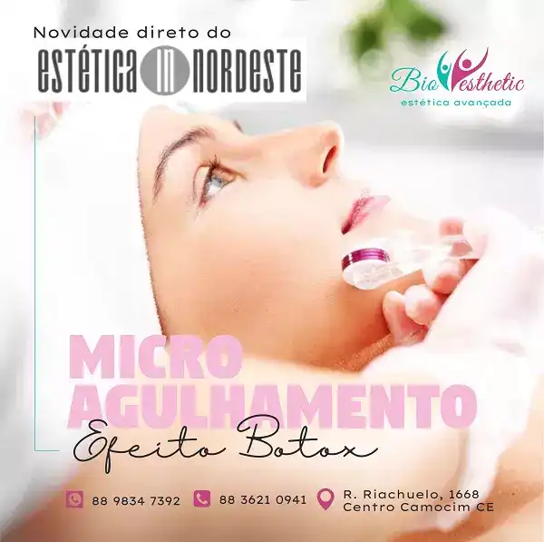Propaganda sobre Micro Agulhamento com Efeito Botox
