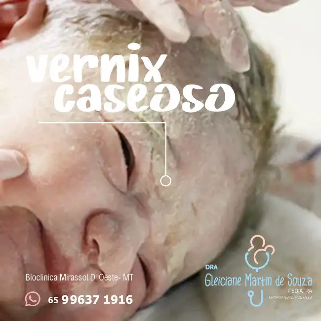 
Propaganda sobre Vernix Caseoso para Clínica Pediatríca



